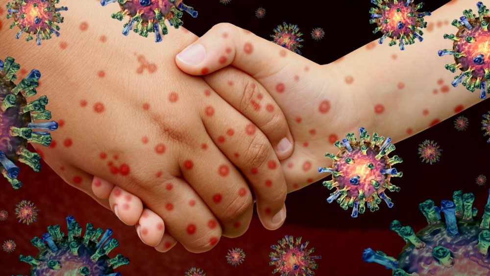 ‘Significant’ breakthrough in fight against ‘world’s most infectious disease’ could wipe it out for good