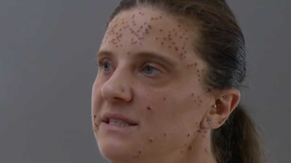 I was kicked off plane over my rare condition…I was humiliated, says nurse