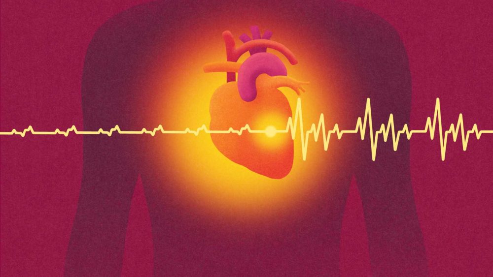 Millions at risk of ‘silent killer’ that triggers heart attack and stroke but don’t realise – are you?
