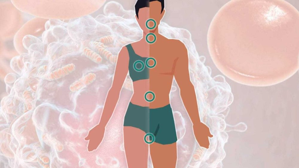 From bloating to losing your voice – the 22 most common cancer symptoms you should get checked today